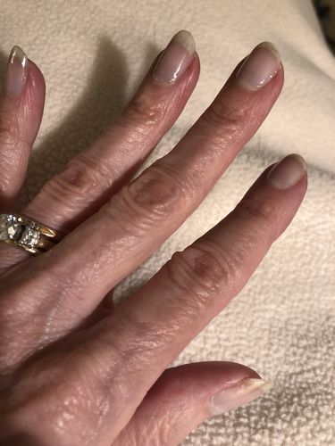 Customer photo review of The Nail System