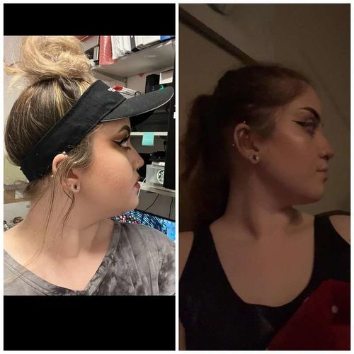 Customer photo review of flysmus™ Lymphvity MagneTherapy Germanium Earrings（Limited time discount 🔥 last day）