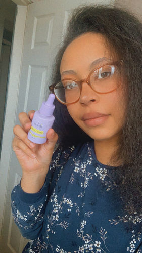 Customer photo review of Dark Circles Treatment