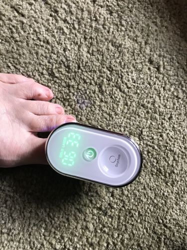 Customer photo review of Onychom - Antifungal Laser Device