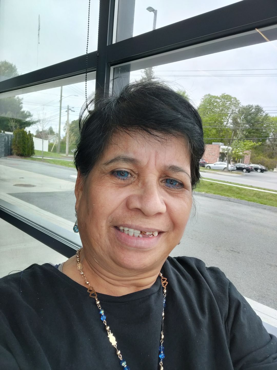 Customer photo review of Vega tricolor Blue Prescription Colored Contact Lenses