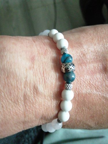 Customer photo review of BRACELETS FORME (stop au grignotage)
