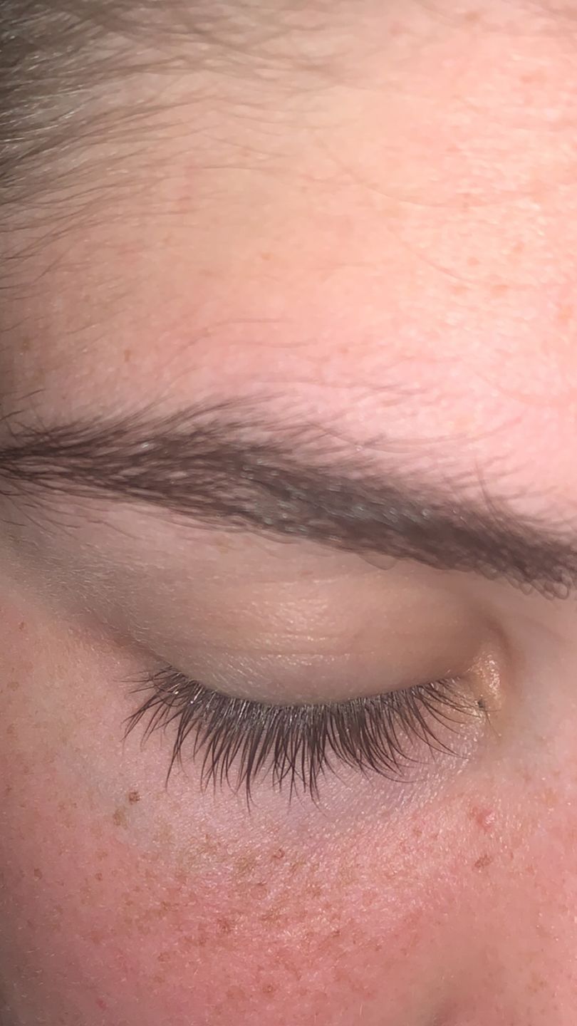 Customer photo review of Eyelash Growth Serum - Original