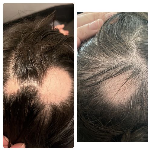 Customer photo review of Growth & Shine Hair Oil