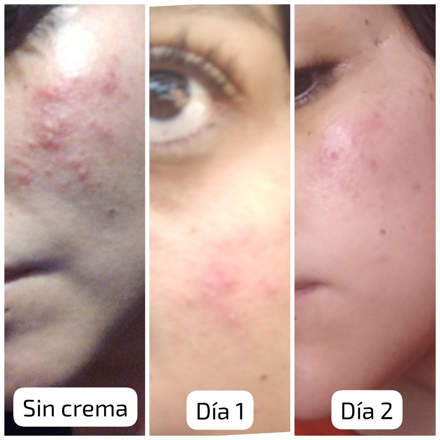 Customer photo review of Manteca Regenerativa Piel Sensible