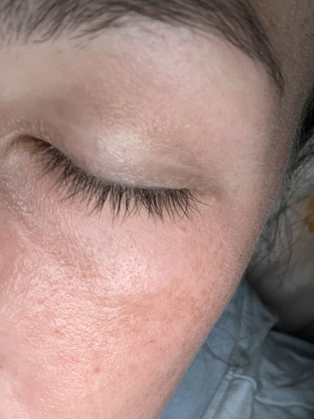 Customer photo review of Eyelash Growth Serum - Original