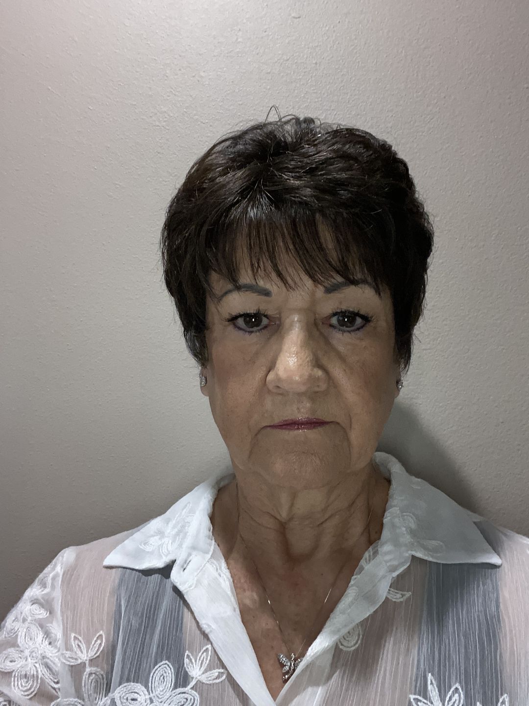 Customer photo review of Best Hyaluronic Acid Anti-Aging Hydrating Serum 1 oz.