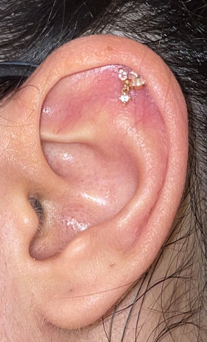Customer photo review of Marquise Droplet Flat-Back Labret - 14K Gold & ASTM F136 Titanium