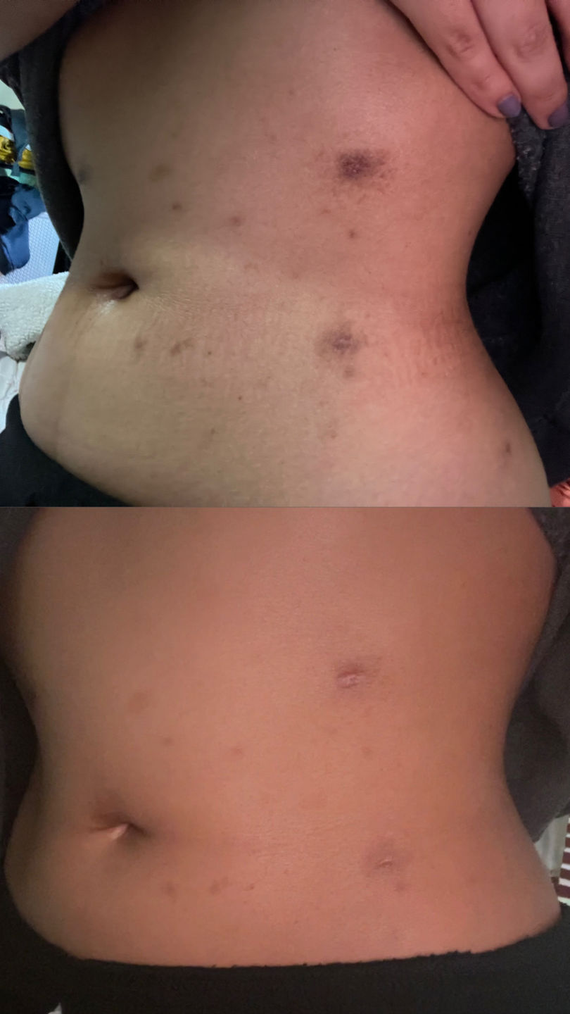 Customer photo review of The Ultimate Body Care Set