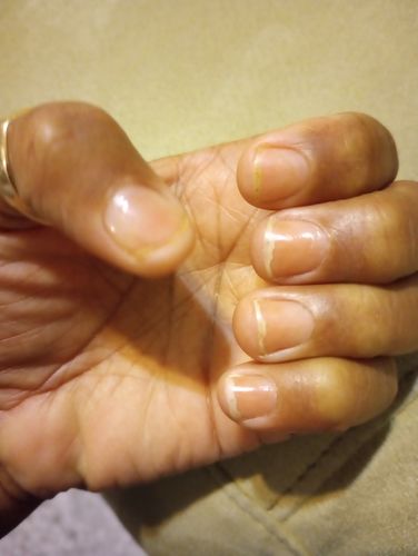 Customer photo review of Rocket Nail Fuel Nail Repair - Clear