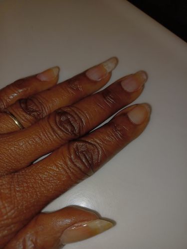Customer photo review of Rocket Nail Fuel Nail Repair - Clear