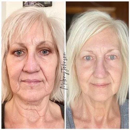 Customer photo review of BUGFB™ Korean Serum（Limited Time Discount 🔥 Last Day）
