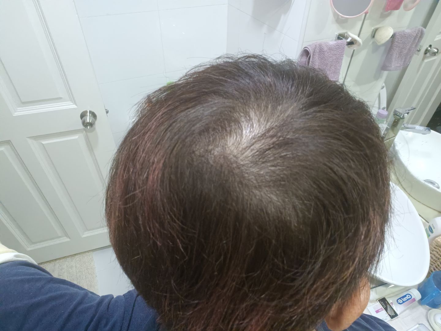 Customer photo review of [ SMIB ] - 115ML Coral Calcium Hair Essence