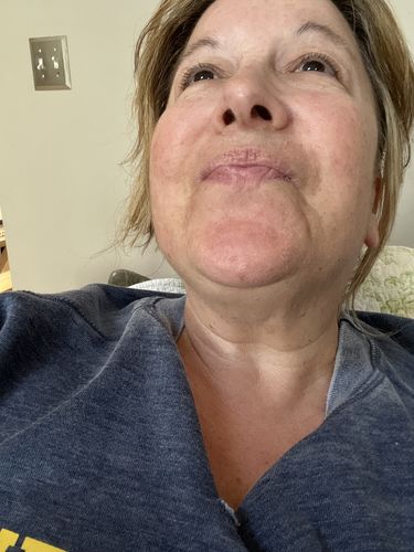 Customer photo review of Face & Neck Deluxe System