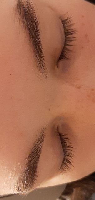 Customer photo review of Eyelash Growth Serum - Original
