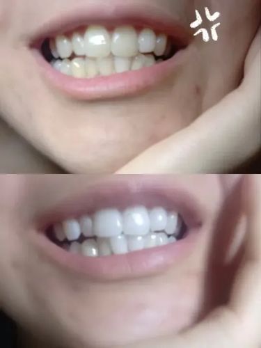 Customer photo review of Farbkorrektur - Strips