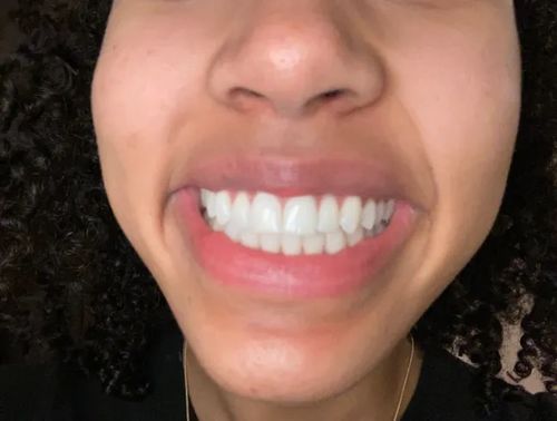 Customer photo review of Farbkorrektur - Strips