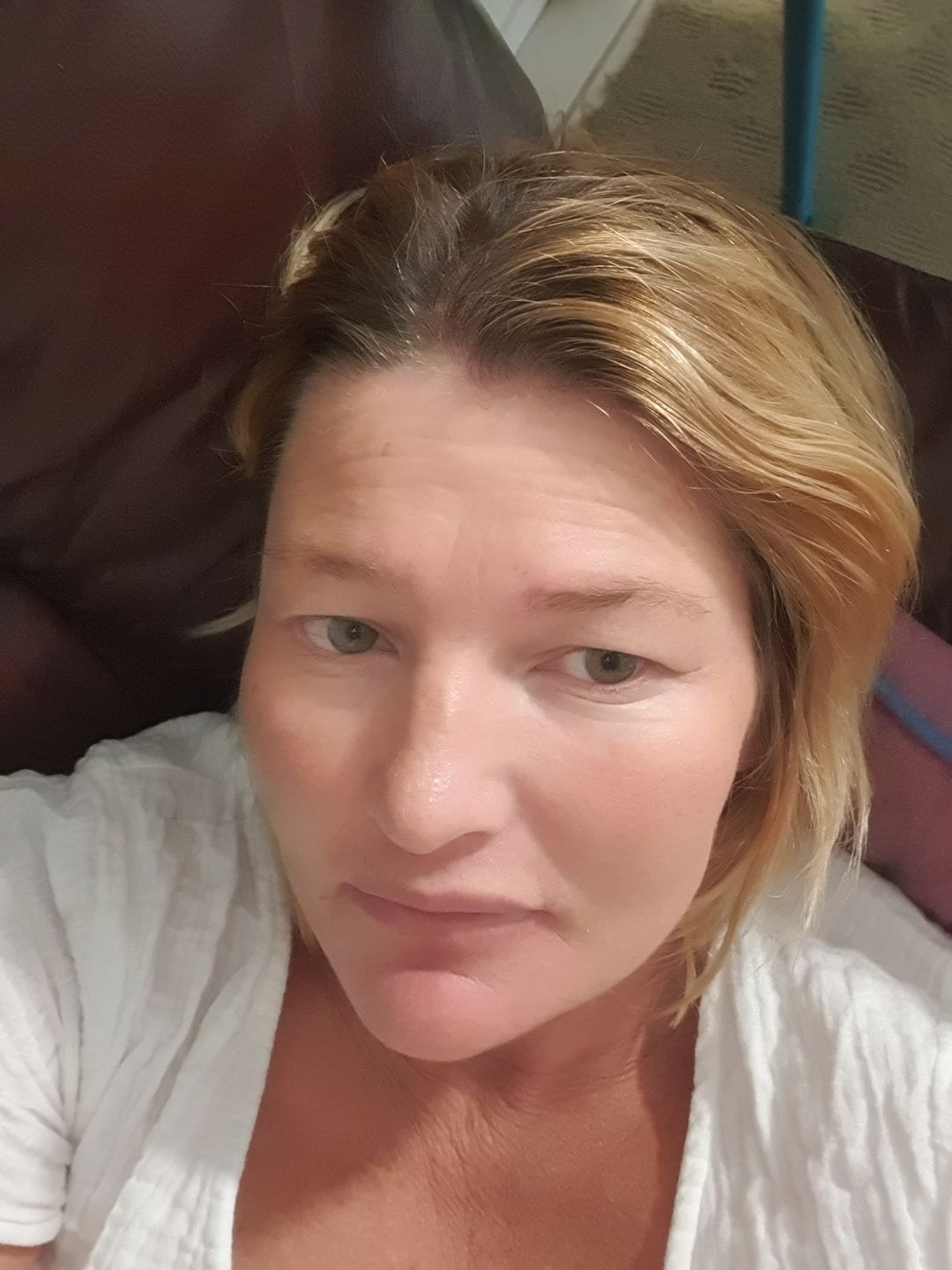 Customer photo review of SEA BUCKTHORN SERUM