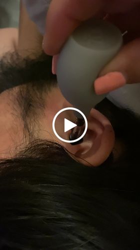 Customer video review of Zōk- Naturally Reduce Pressure and Tension Inside the Head