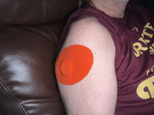 Customer photo review of Skin Grip Original - Medtronic Guardian/Enlite Adhesive Patches