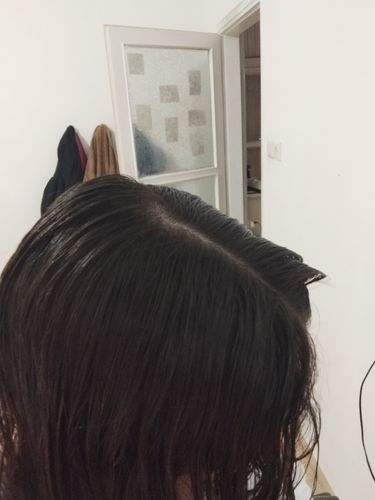 Customer photo review of ערכה דו שלבית לטיפול בקשקשים | SEBO DANDRUFF KIT