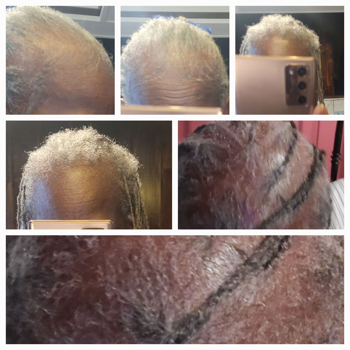 Customer photo review of Super G  Vital Growth Serum Water-based scalp serum infused with white willow bark