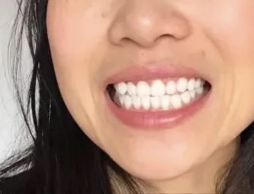 Customer photo review of Farbkorrektur - Strips