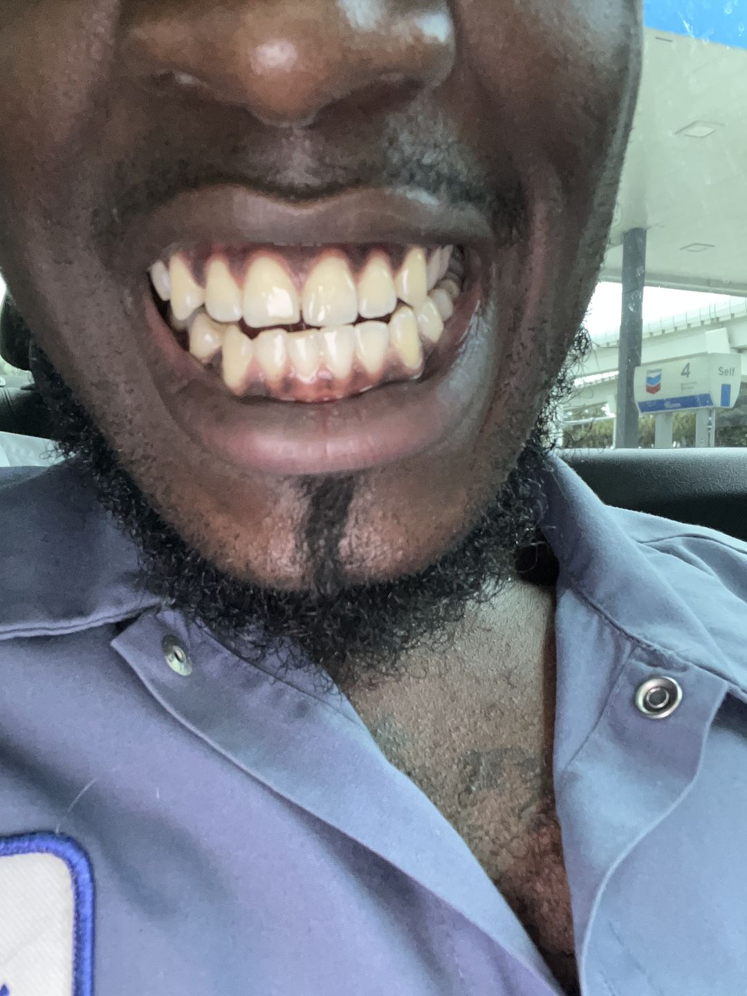 Customer photo review of Jamaican Chew Stick Herbal Tooth Powder