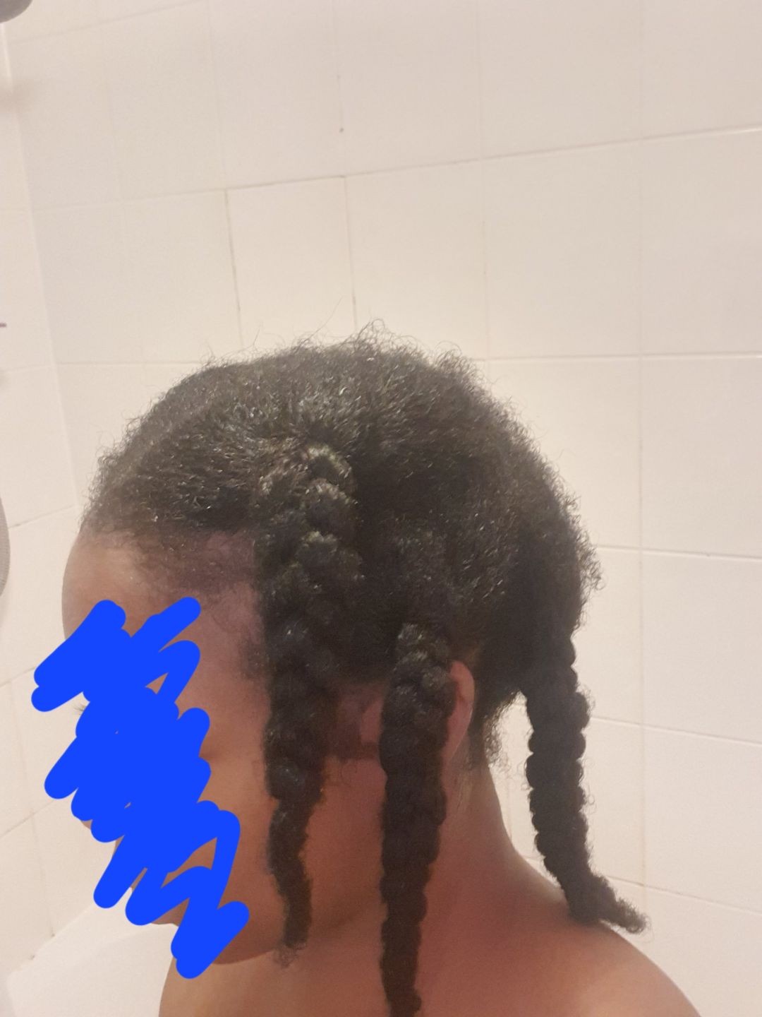 Customer photo review of Hair Recovery Bundle