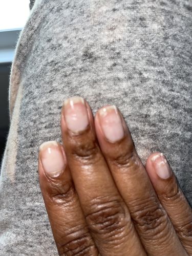Customer photo review of Rocket Nail Fuel Nail Repair - Clear