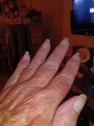 Customer photo review of Rocket Nail Fuel Starter Kit