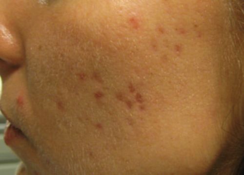 Customer photo review of Anti Aging Therapy: Age-Reverse & Beauty Products Frequencies