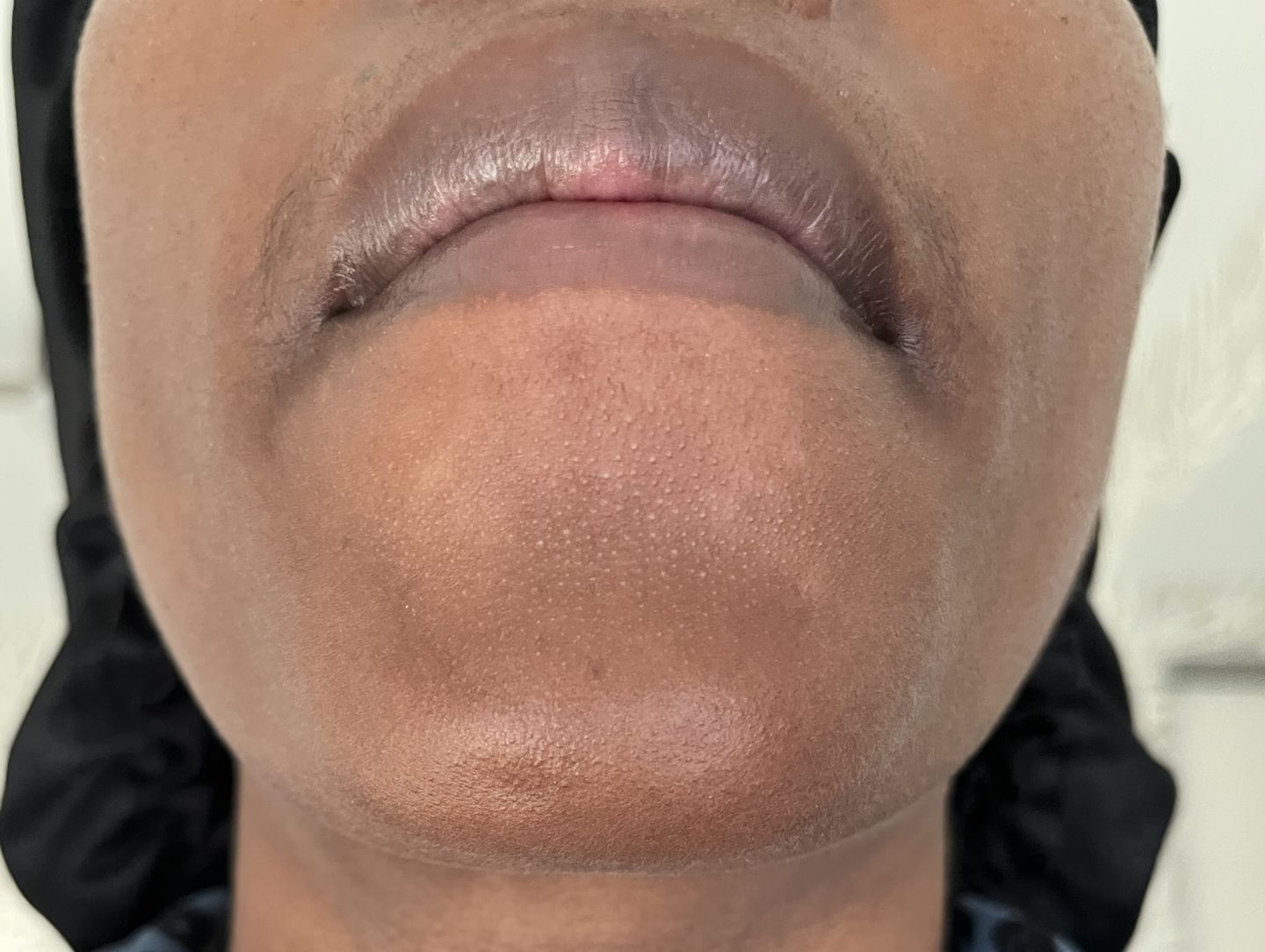 Customer photo review of Ultra Bright Lightening Cream