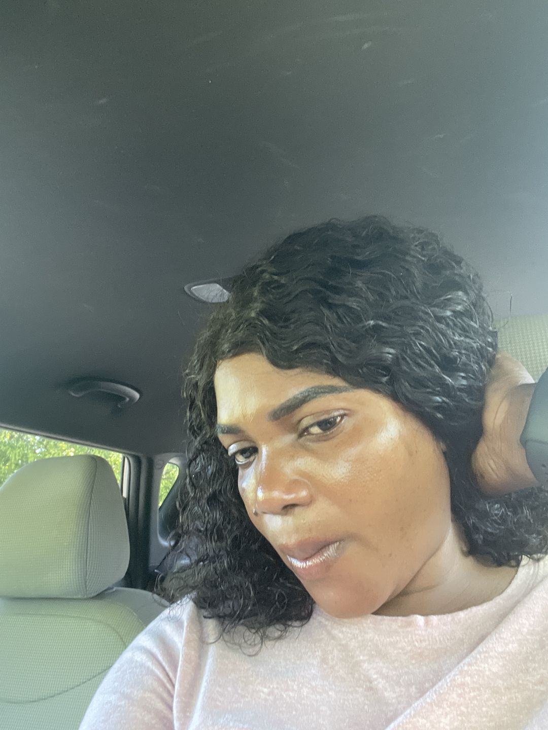 Customer photo review of Turmeric face wash for black spots,acne & glow