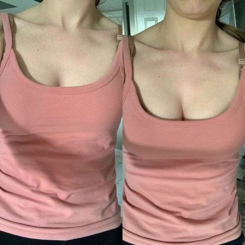 Customer photo review of Natural Breast Enhancement Cream