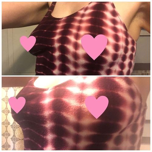Customer photo review of Natural Breast Enhancement Cream