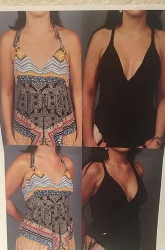 Customer photo review of Natural Breast Enhancement Cream