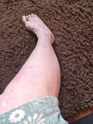 Customer photo review of Multi Strain Biotic