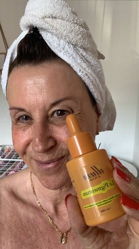 Customer photo review of Le Pigmentum - Hyperpigmentation Treatment