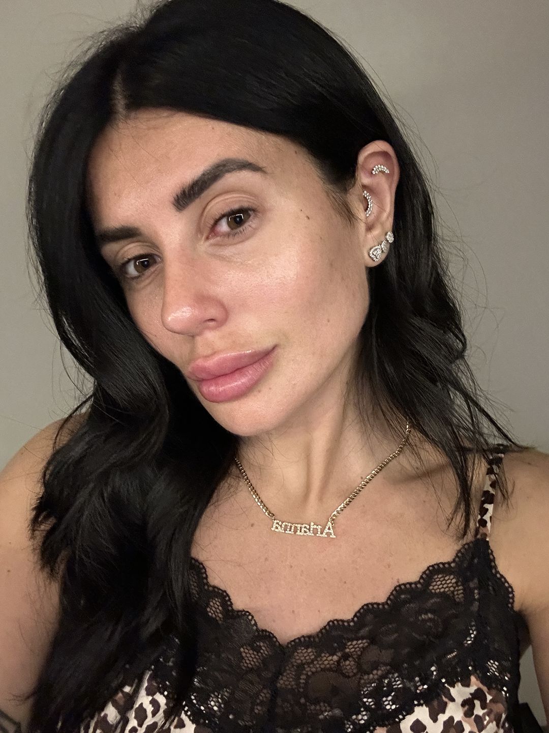 Customer photo review of Soothing Serum