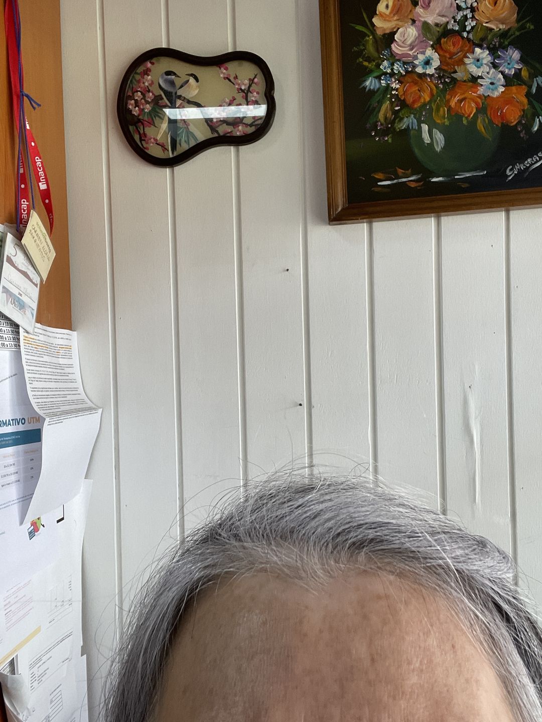 Customer photo review of Shampoo anticaída en barra
