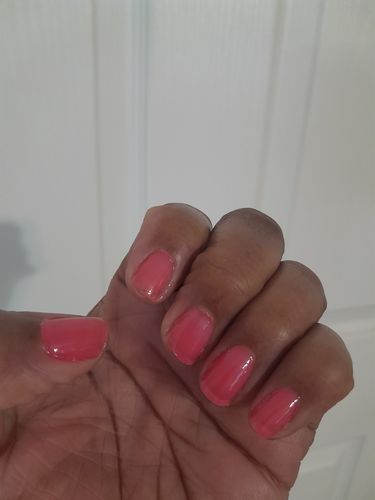 Customer photo review of Rocket Nail Fuel Nail Repair - Clear