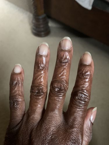 Customer photo review of The Nail Starter Kit