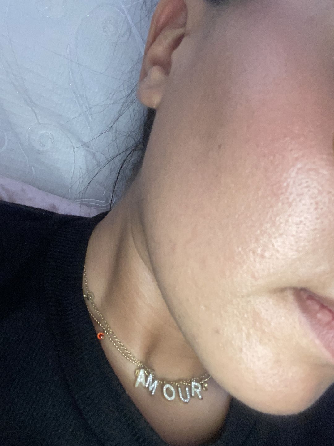 Customer photo review of Acide Hyaluronique - 1 mois
