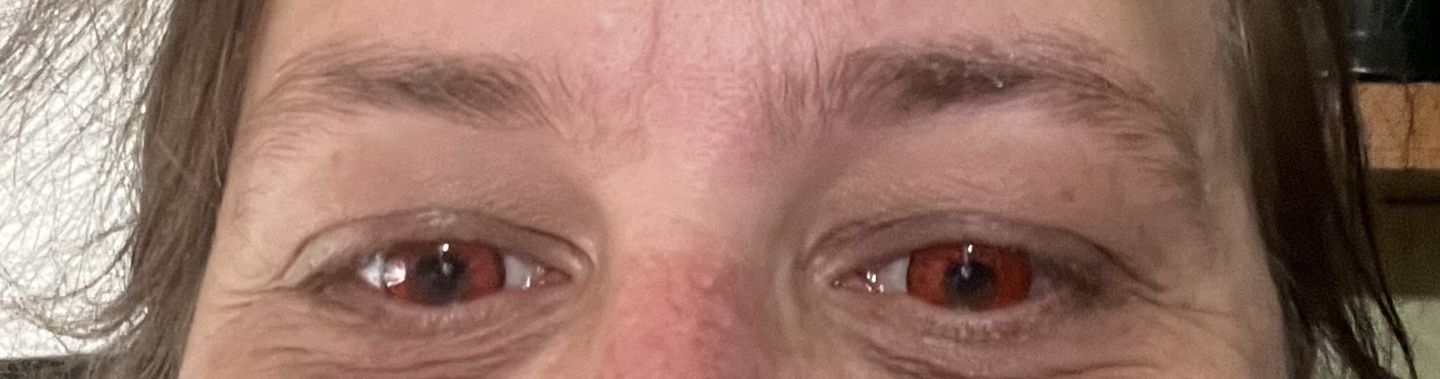 Customer photo review of Cosplay ICE Red Prescription Colored Contact Lenses