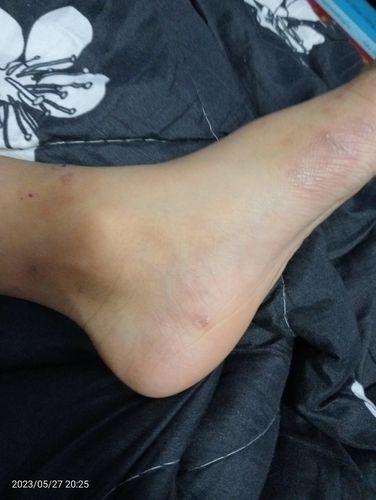 Customer photo review of Jolicare Cream