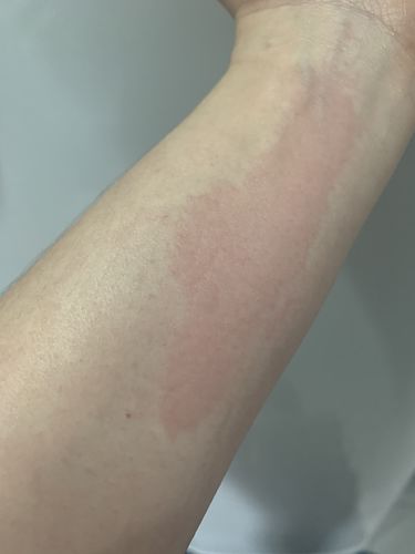 Customer photo review of BUMBUM CREAM 50g