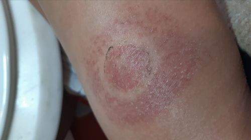 Customer photo review of Underlayer by FlexiArmor