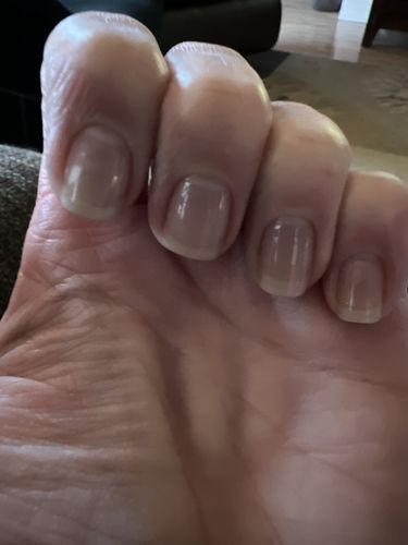 Customer photo review of The Nail System