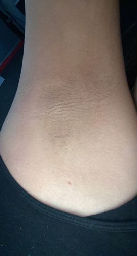 Customer photo review of Skin Glow Kit